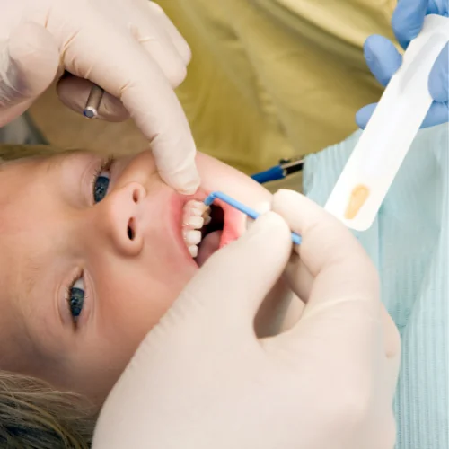 Understanding the Benefits of Fluoride in Dental Care