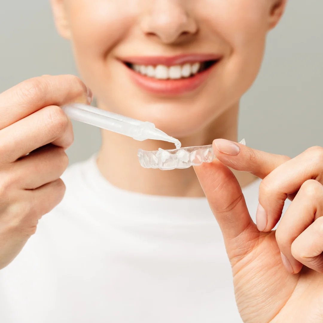 What's the Best Way to Whiten Your Teeth? Safe, Effective Options