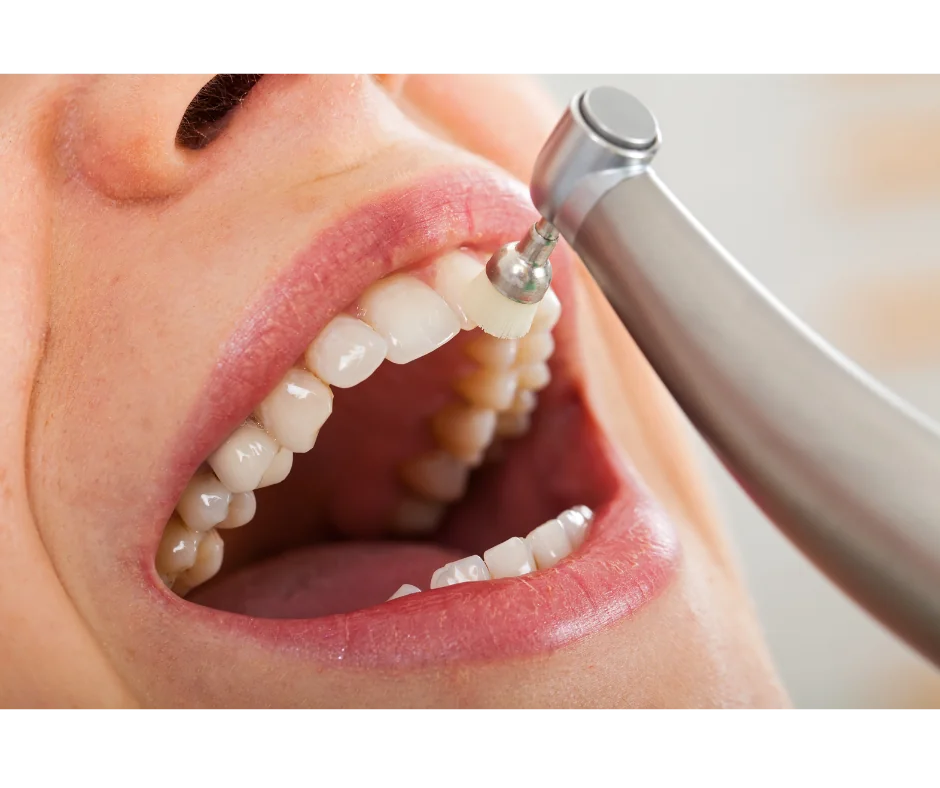 Dental Cleanings & Exams