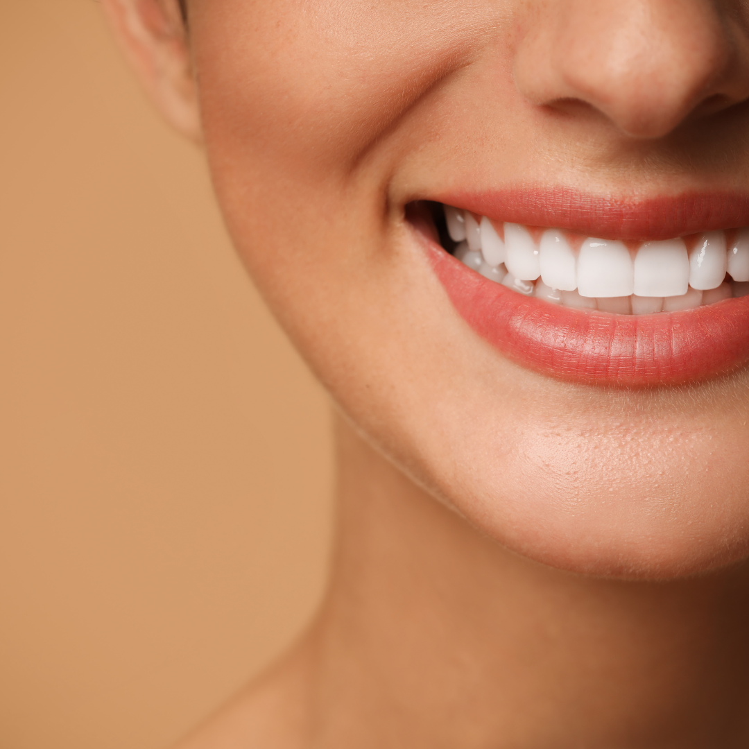 Cosmetic Dentistry for Front Teeth