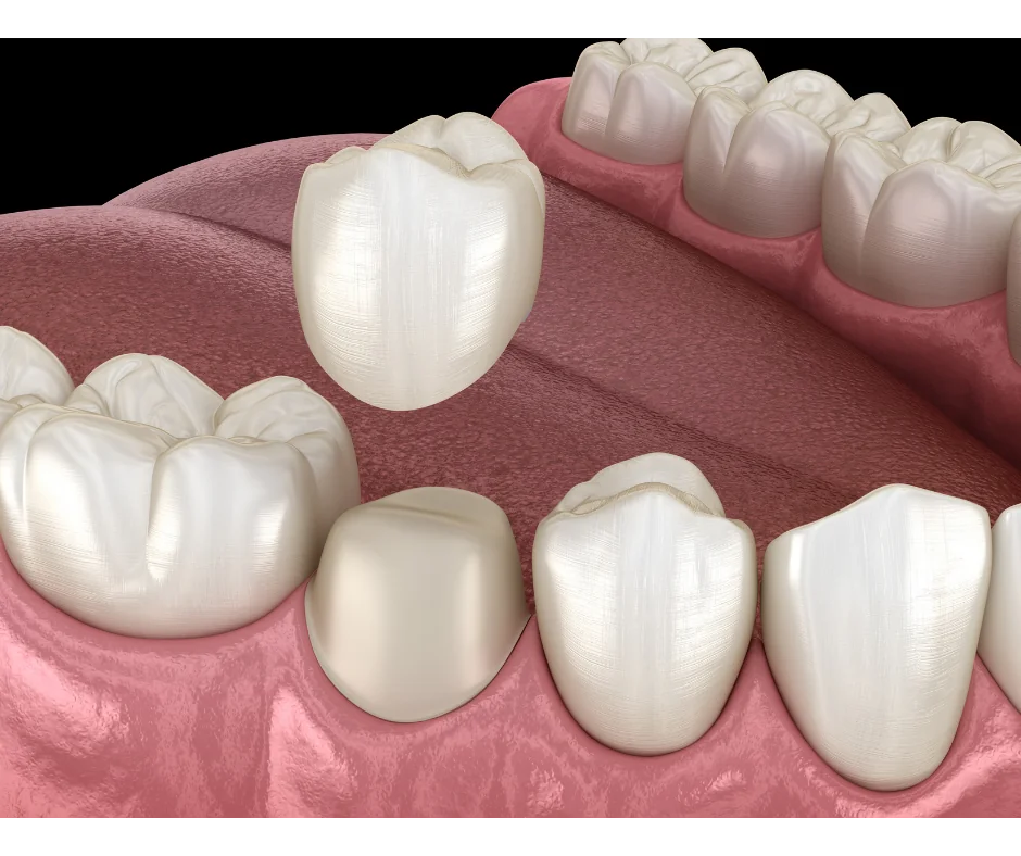 Restorative Dentistry