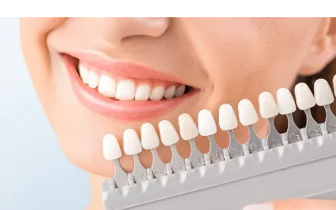 Teeth Whitening