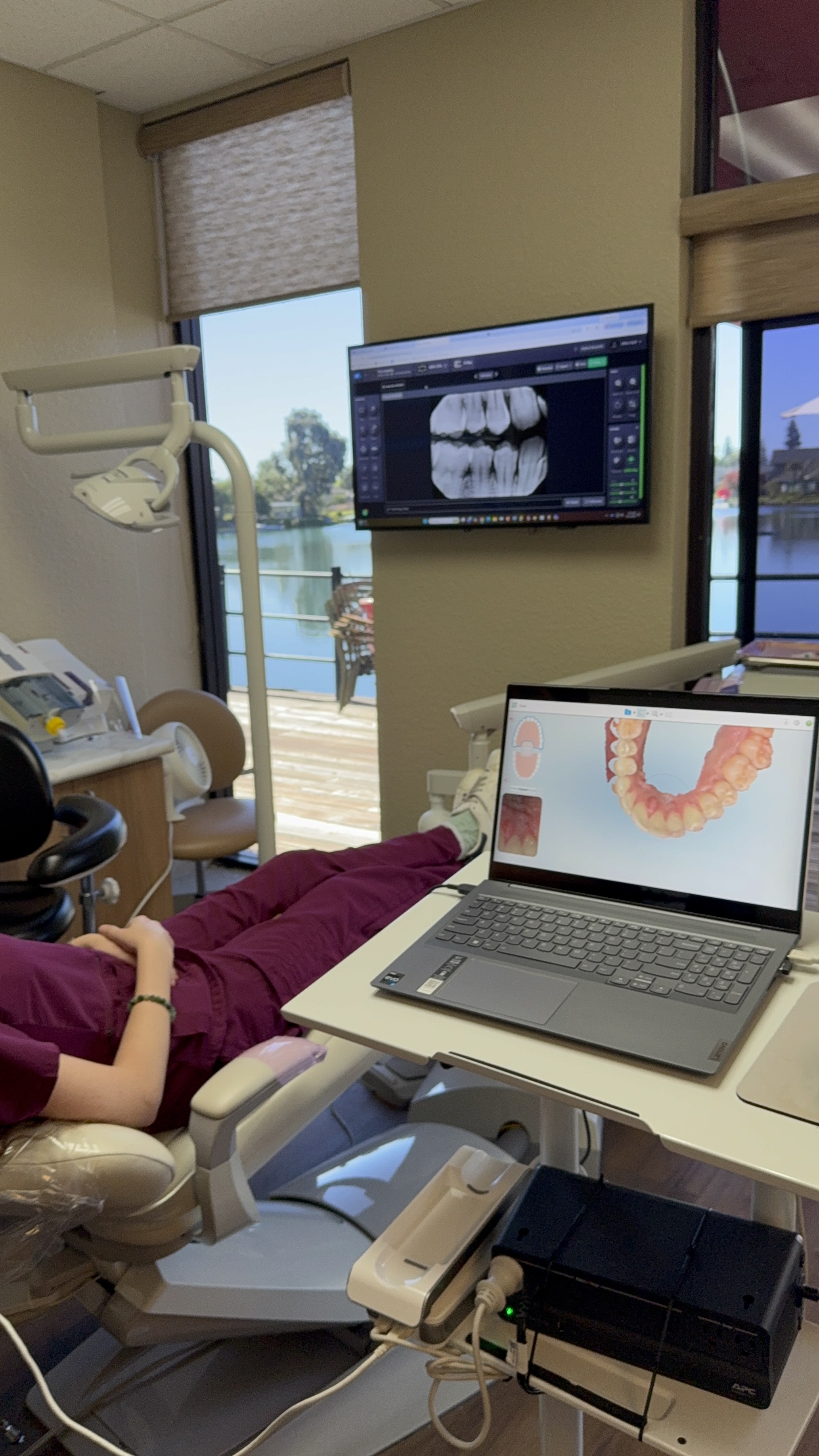 A patient's full-arch 3D iTero scan shown on the chairside laptop at Stephen Cheung DDS, with digital X-rays on the wall monitor and the Lodi lakeside view through the window